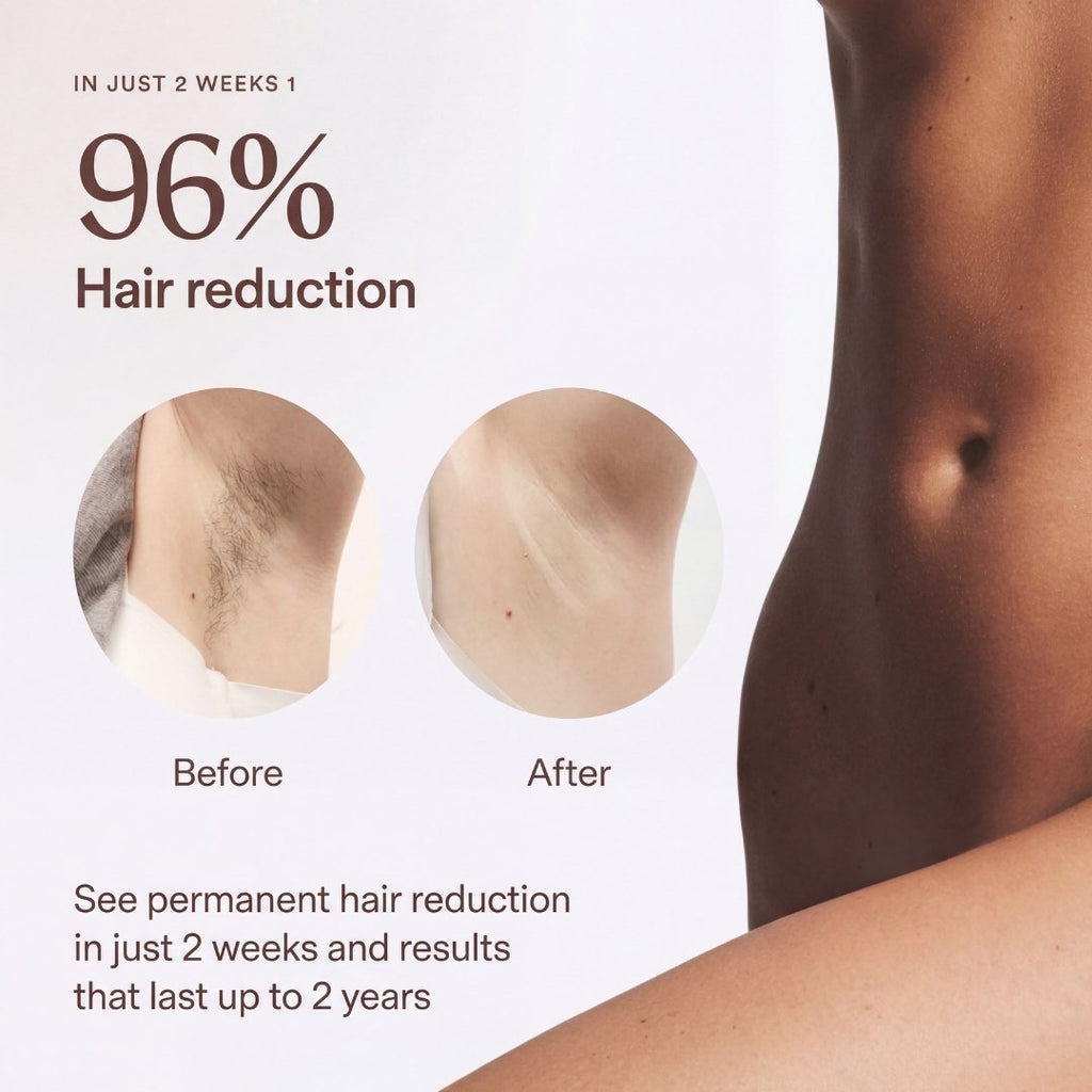 HE4'IPL Hair Removal