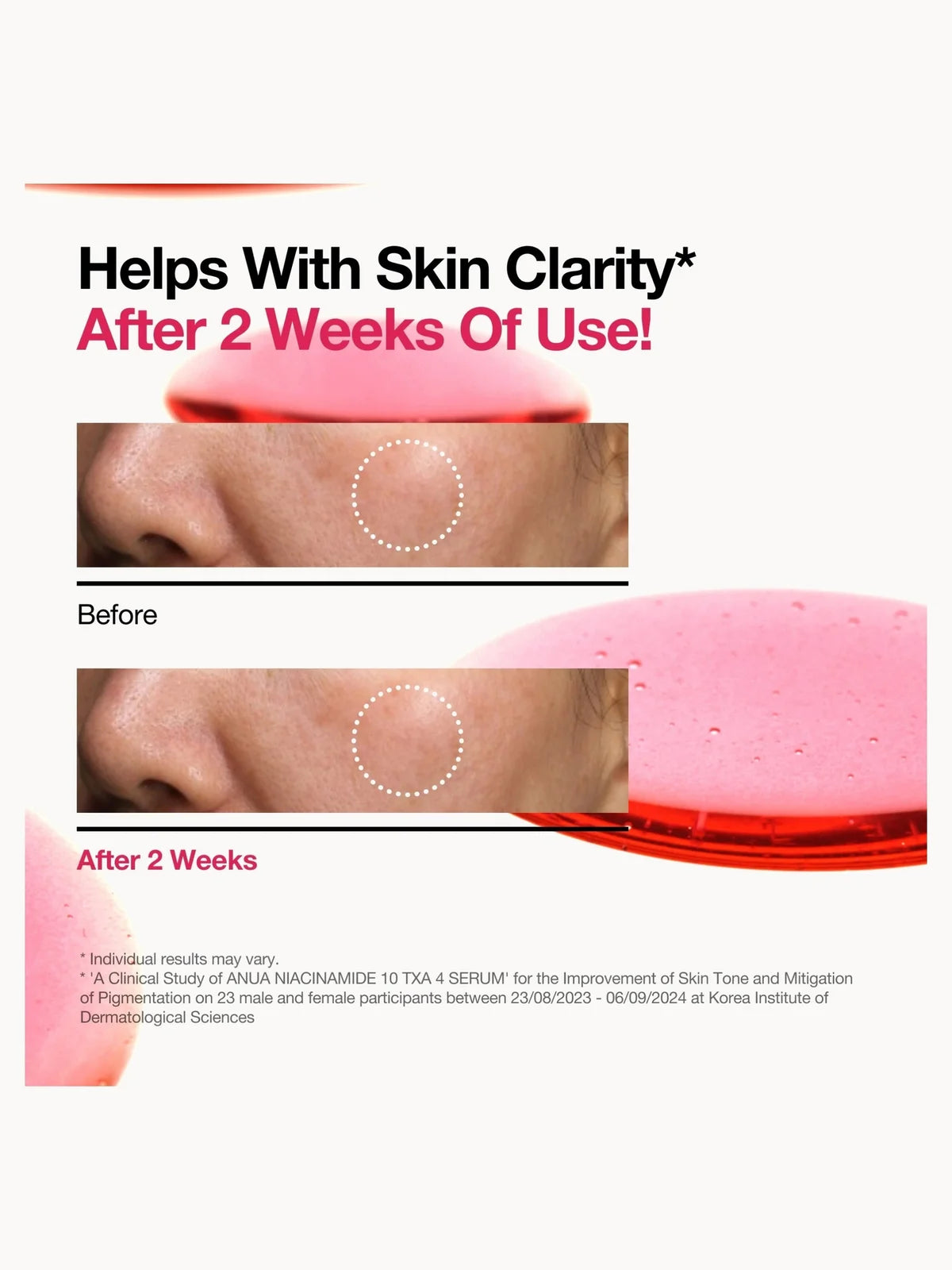Anua Niacinamide 10% + TXA 4% Serum 30ml